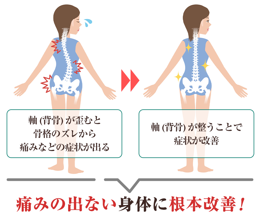 痛みの出ない身体に根本改善